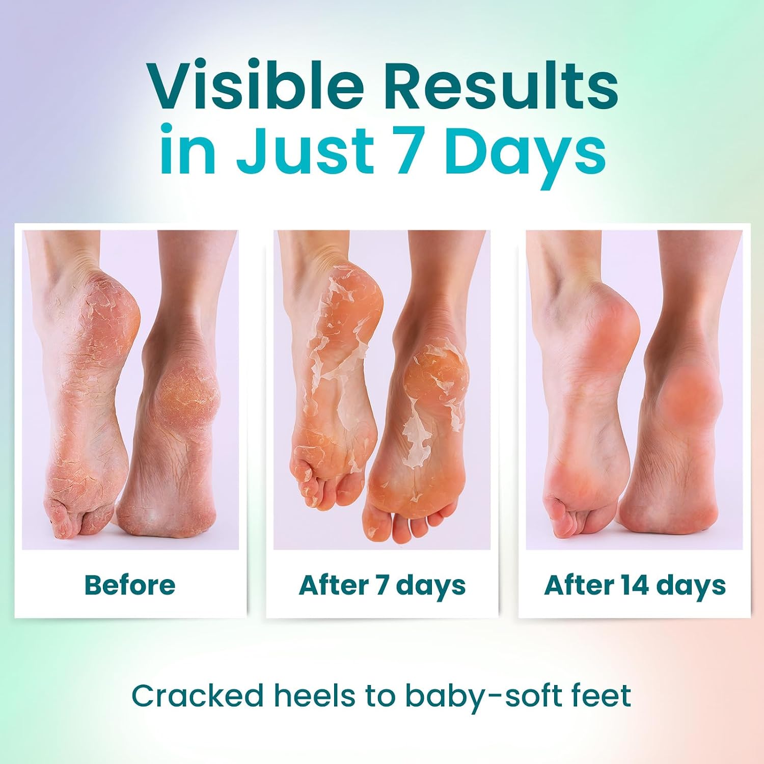 Foot Peeling Mask (6 pairs) Exfoliating Foot Mask for Dry Cracked Feet with Lavender, Aloe Vera, Peach & Shea Butter