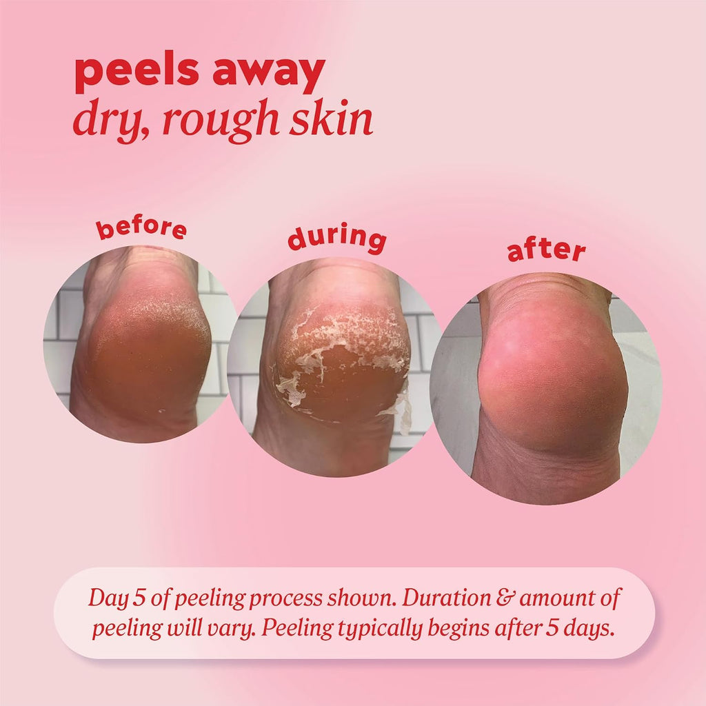 Foot Peel Mask Callus Remover, 2 pack - Dead Skin Remover, Foot Exfoliator, Cracked Heel Treatment, Peeling Callus