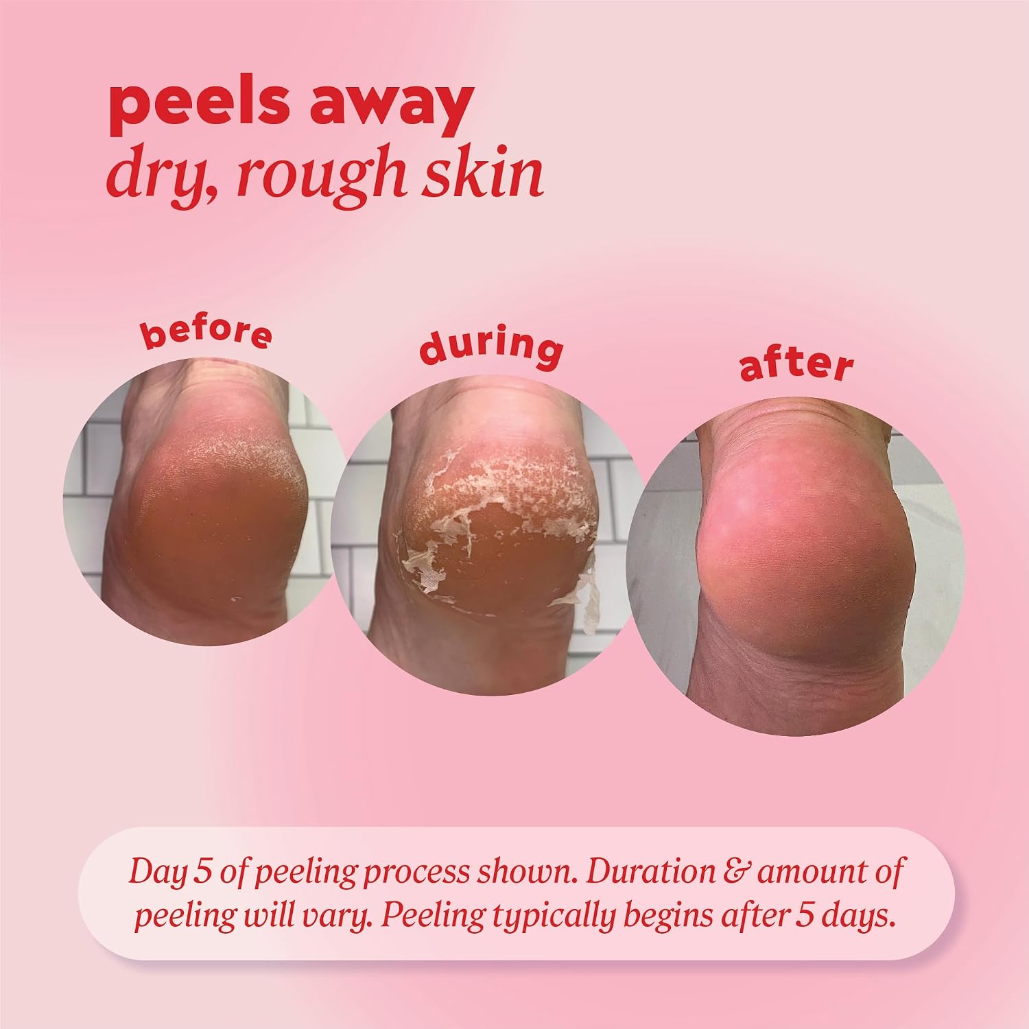 Foot Peel Mask Callus Remover, 2 pack - Dead Skin Remover, Foot Exfoliator, Cracked Heel Treatment, Peeling Callus