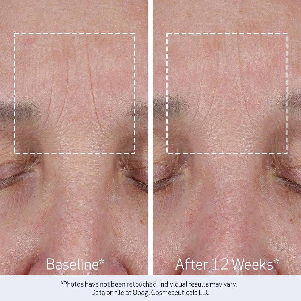 Obagi ELASTIderm Lift Up & Sculpt Facial Moisturizer – Clinically Proven Anti-Aging Face Cream that Visibly Firms &
