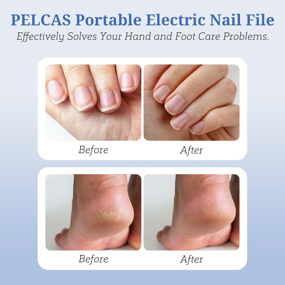 Electric Nail File, Manicure and Pedicure Kit 5 Speeds & LED Light