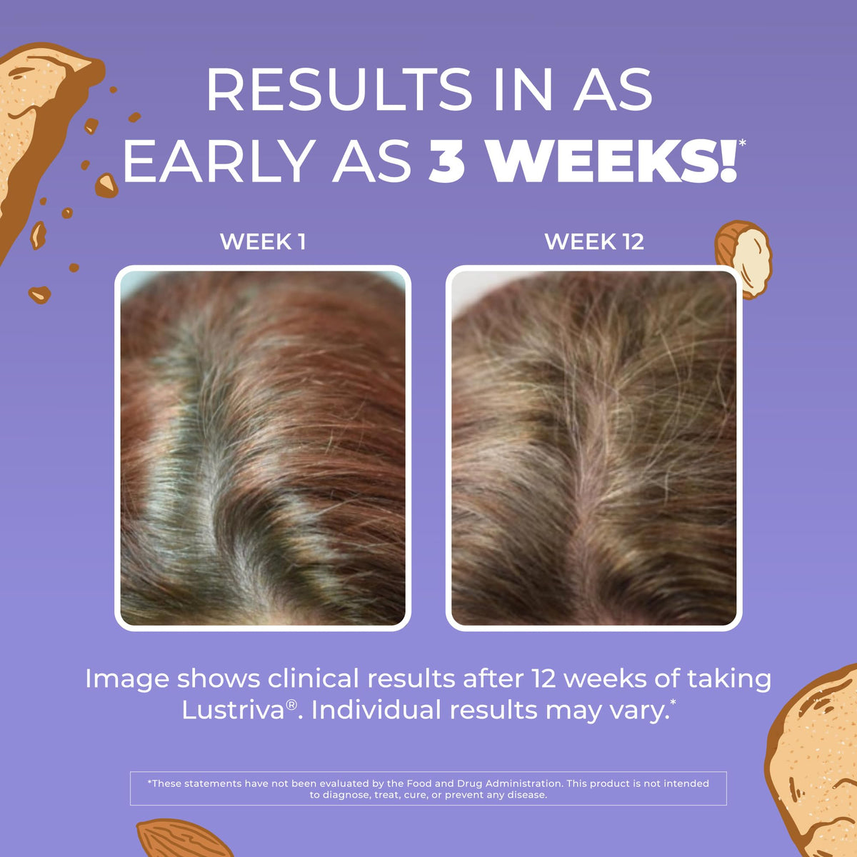 Hair Growth Max Liposomal 10000mcg Biotin, Thicker Hair, 15.22oz