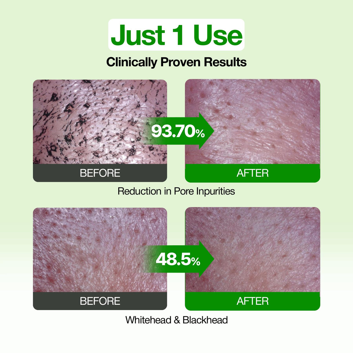 Green Tomato Pore Clay Mask Cleanser for Deep Cleansing, 4.05 fl oz
