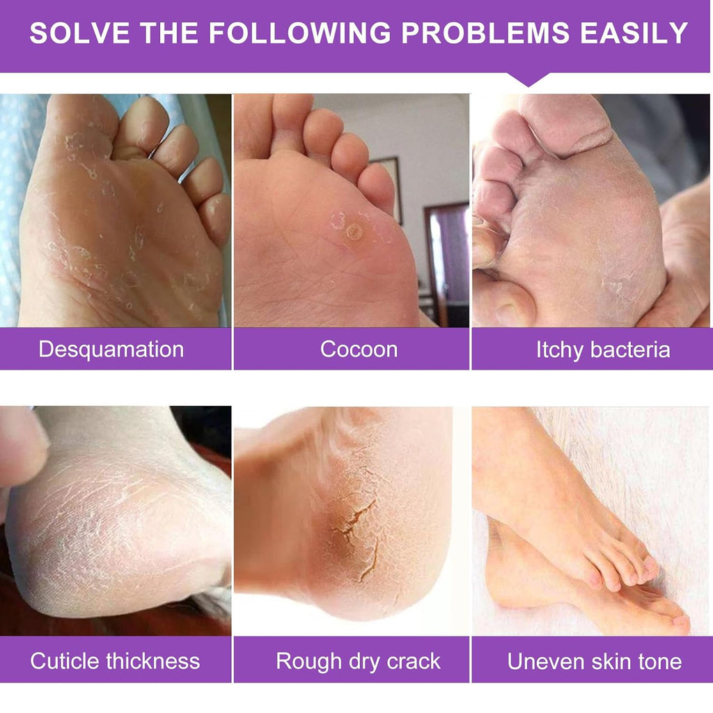 Foot Peeling Mask 5 Pack, Foot Peel Mask Remove Dead Skin, Rough Callus and Cracked Heels, Dry Skin Moisturizer for