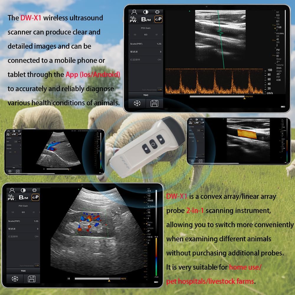 Dual Probe Wireless Color Doppler Ultrasound Machine 3.2MHZ and 7.5MHZ Probe, Wireless Ultrasound Machine for Android