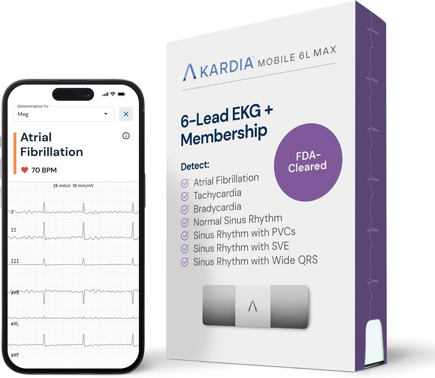 6L Max EKG Monitor, Includes One-Year KardiaCare Membership, FDA-Cleared Heart Monitor, Medical-Grade Results in 30
