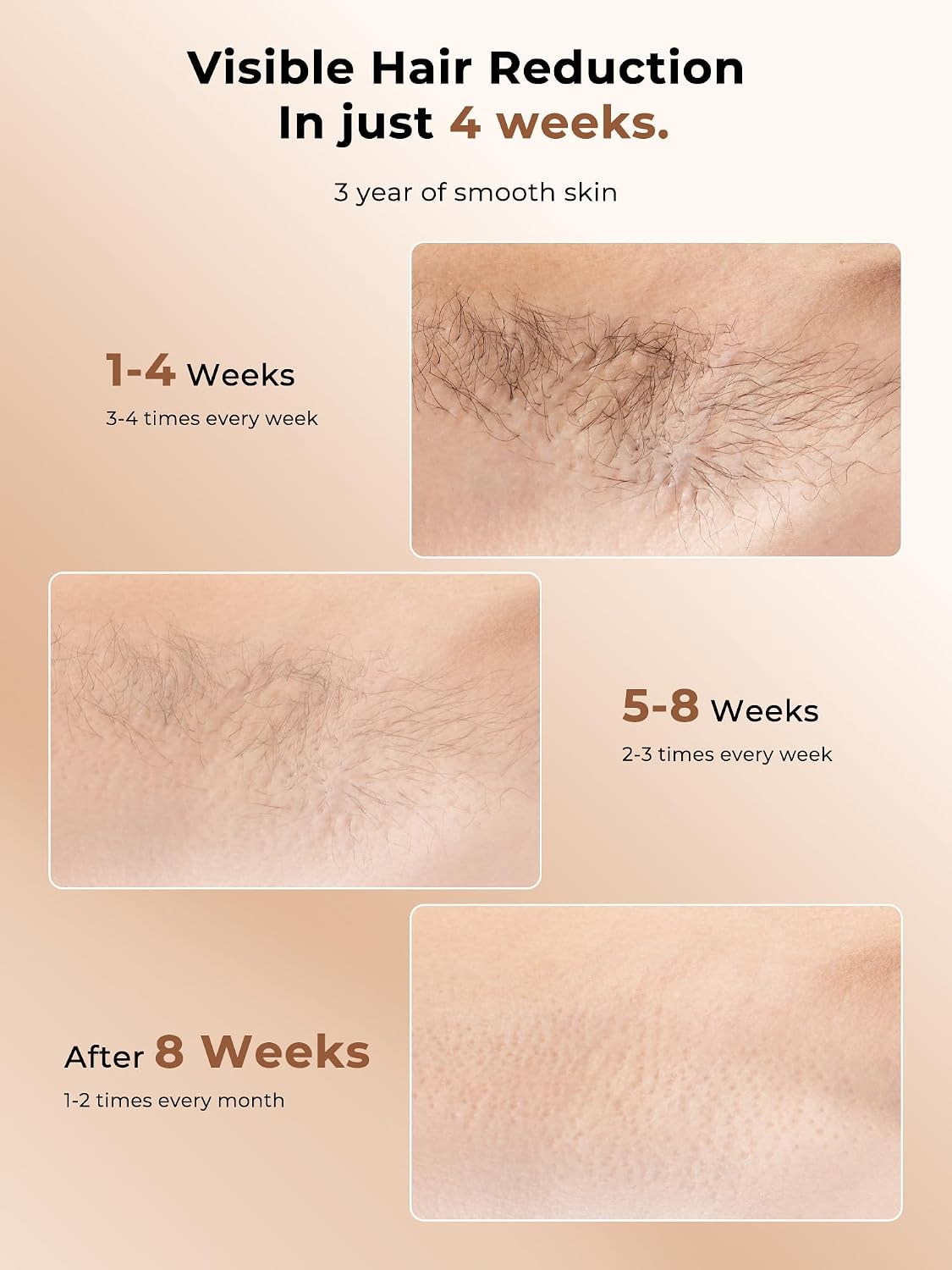 Laser Hair Removal for Women, 97.6% Hair Reduction in 2 Session, 5℃ Ice Cooling IPL Hair Removal Device, Hair Removal