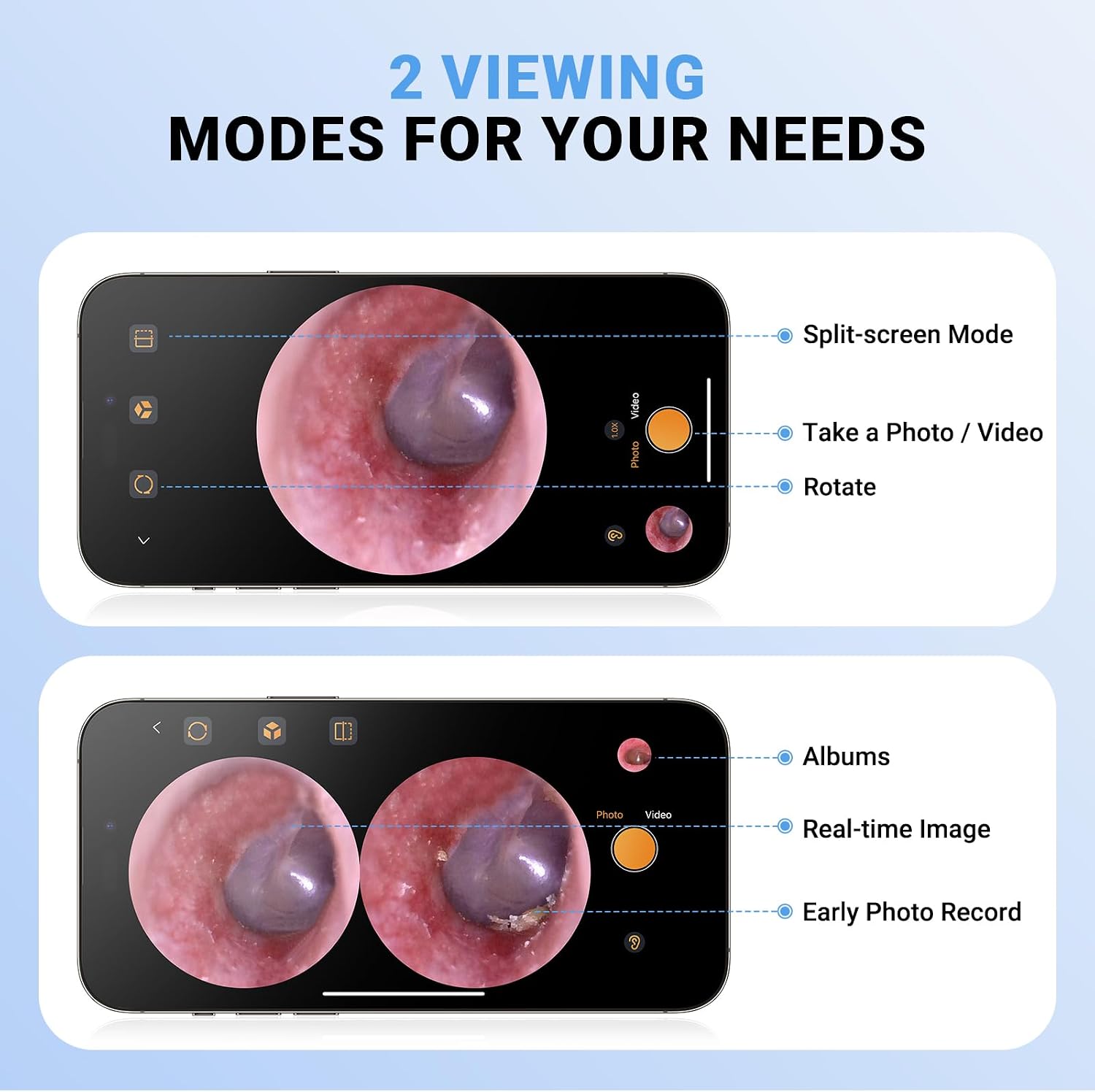 Otoscope Camera with Light 720P HD, USB-C Ear Camera, Plug & Play Ear Scope