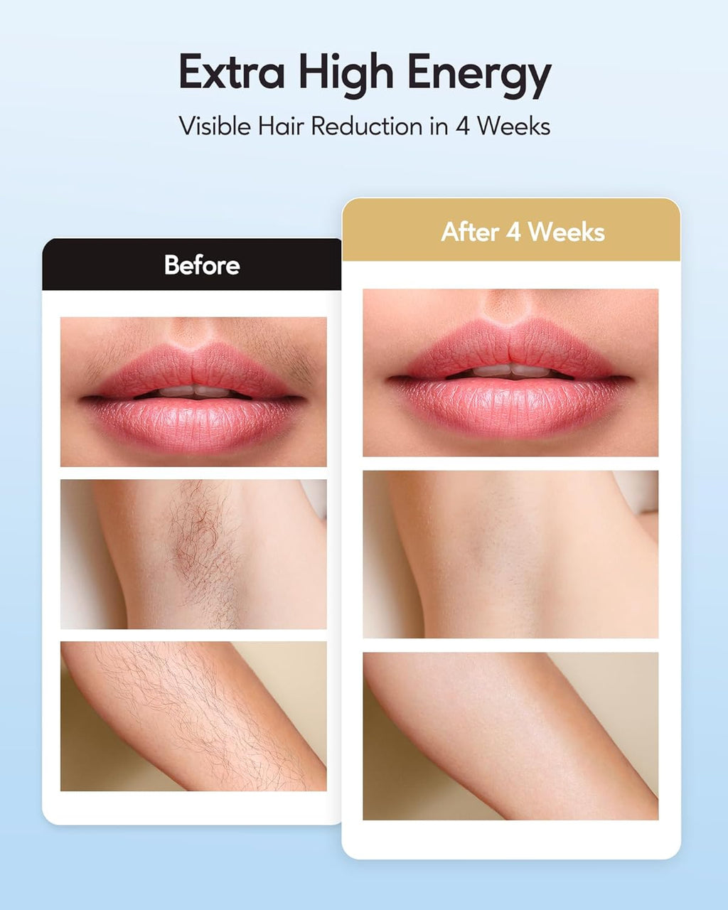IPL Hair Removal with Ice Cooling Care Function for Women | Long-Lasting Results,999,999 Flashes Painless Hair Removal