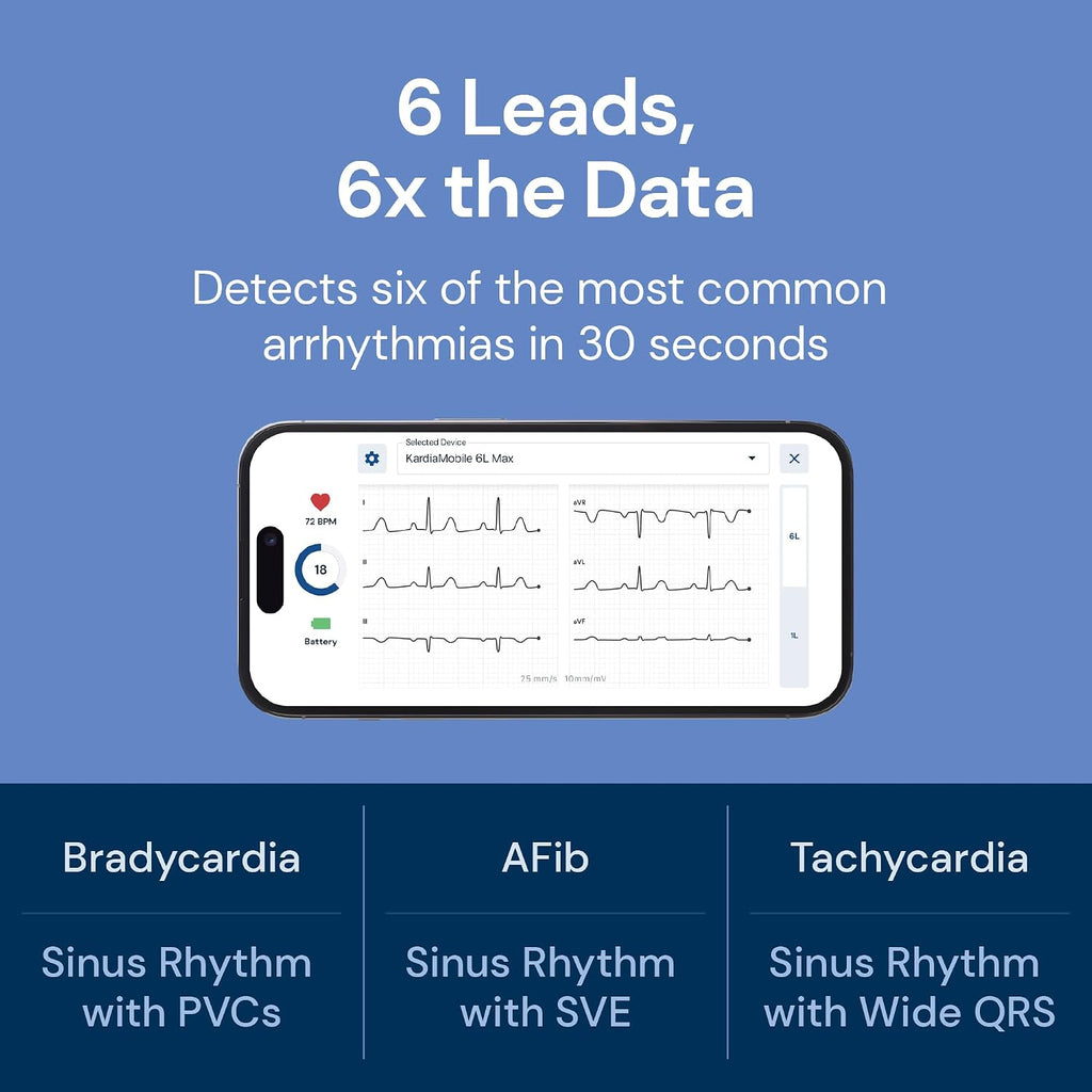 6L Max EKG Monitor, Includes One-Year KardiaCare Membership, FDA-Cleared Heart Monitor, Medical-Grade Results in 30