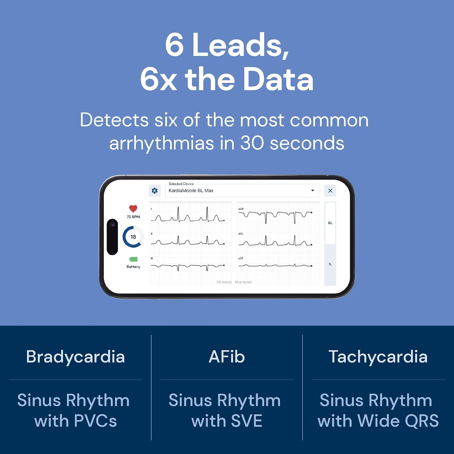 6L Max EKG Monitor, Includes One-Year KardiaCare Membership, FDA-Cleared Heart Monitor, Medical-Grade Results in 30