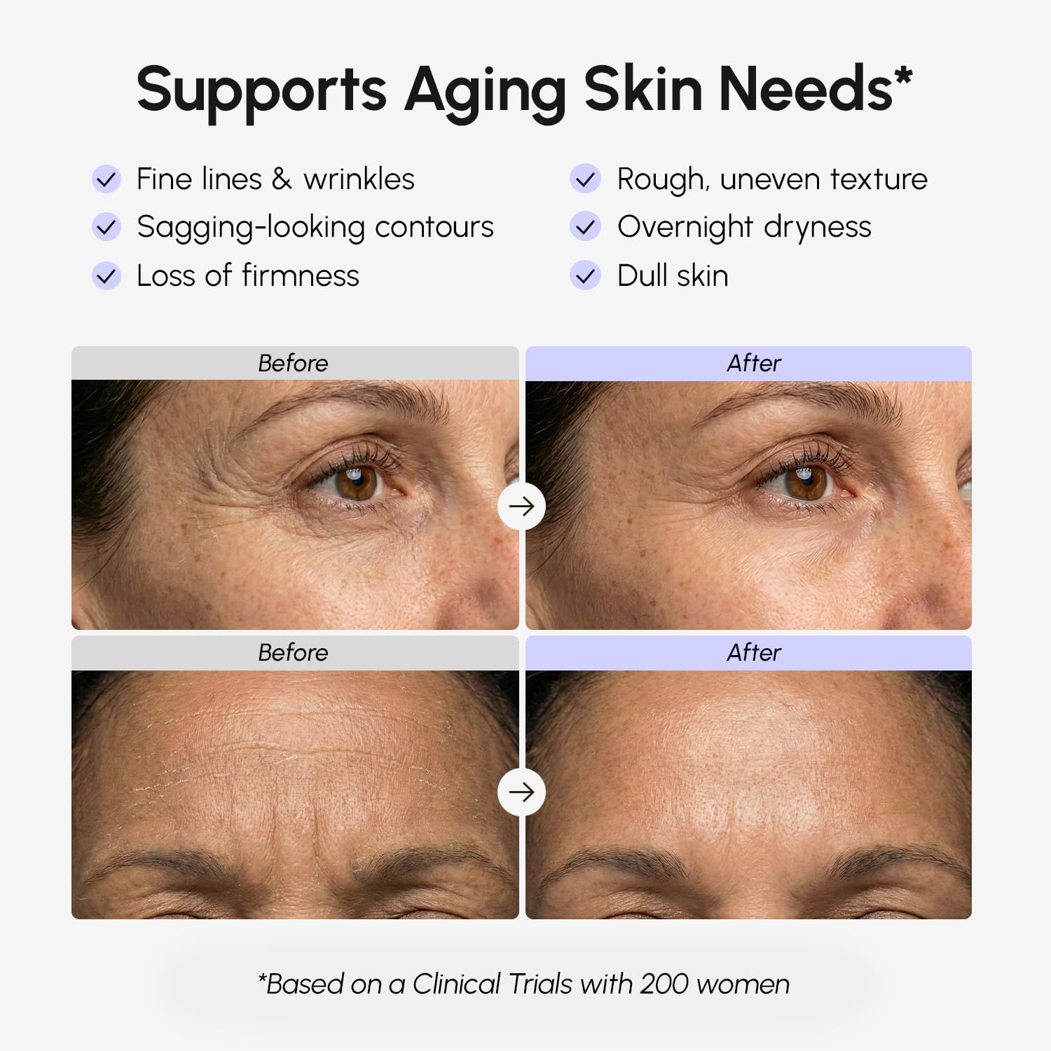 Face Moisturizer – Firming & Lifting Face Cream for Women with Collagen, Retinol & Hyaluronic Acid – Day & Night