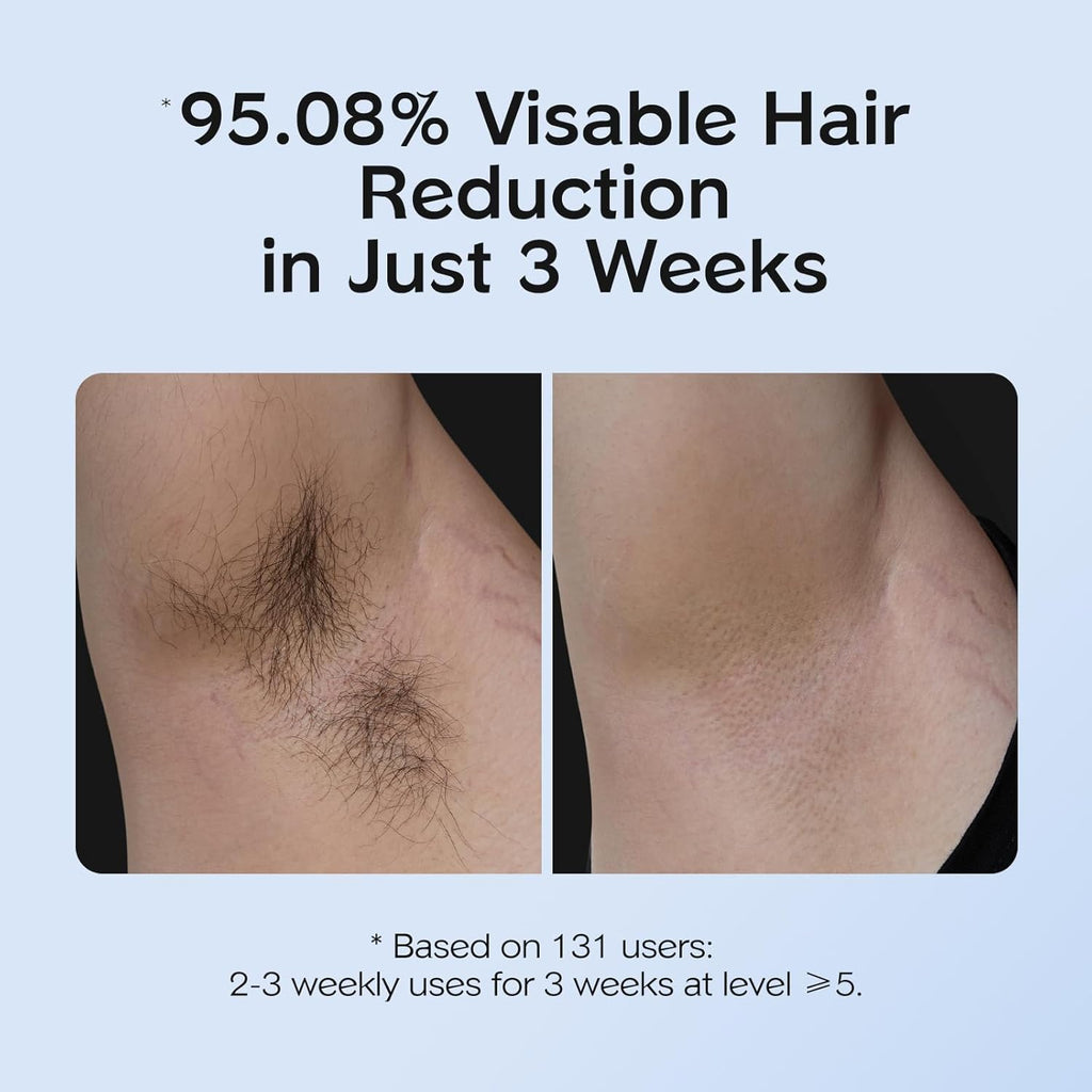 IPL Hair Removal with Ice Cooling Care Function for Women,Long-Lasting Results,999,999 Flashes Painless Hair Removal