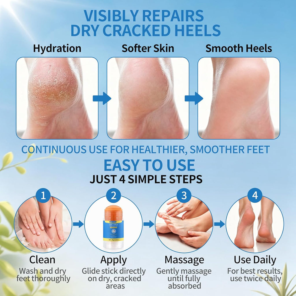 60% Urea Foot Cream Stick with 2% Salicylic Acid - Maximum Strength Callus Remover for Dry Cracked Heels, Hands