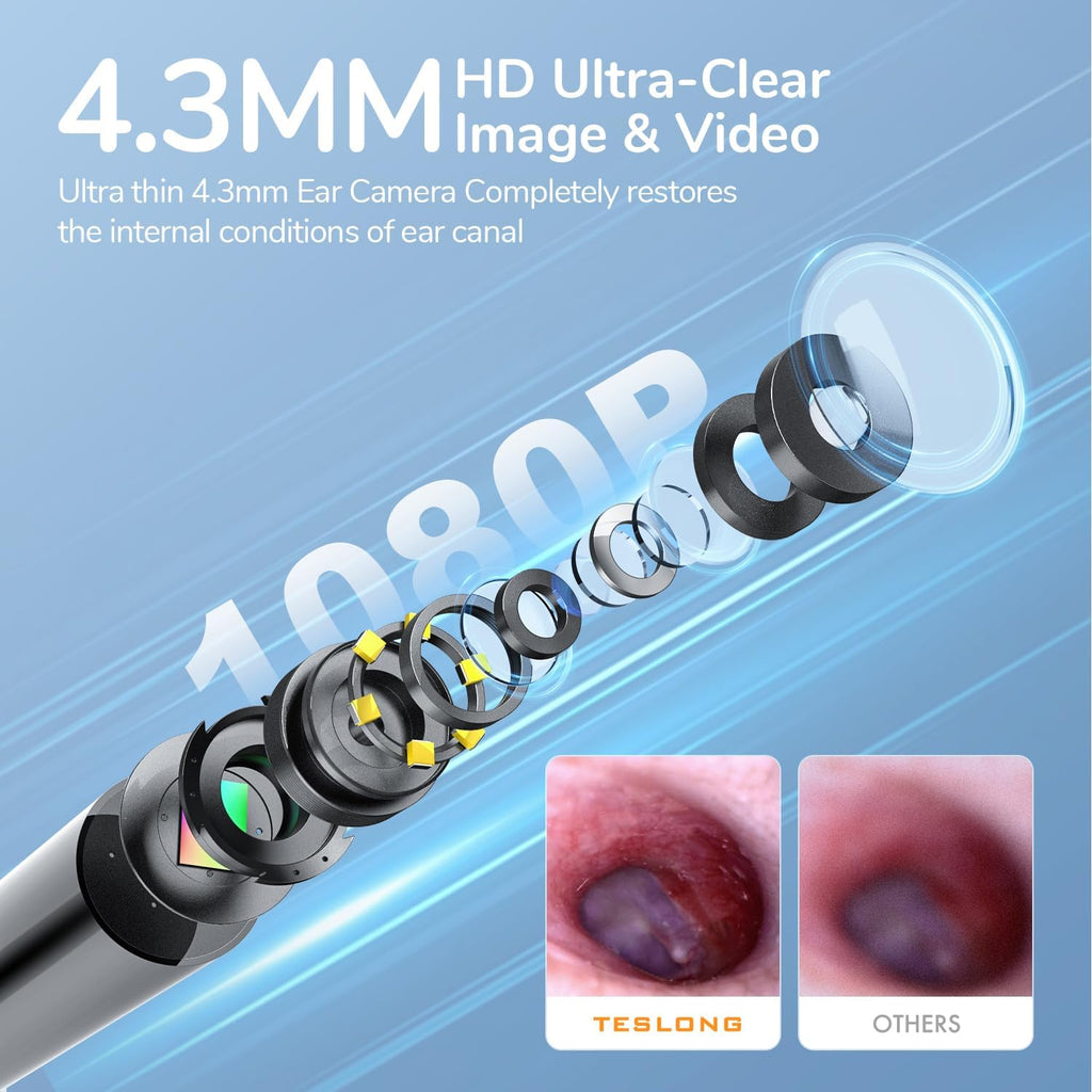 Digital Otoscope with Light 1080P Full HD Otoscope Camera for USB-C Devices