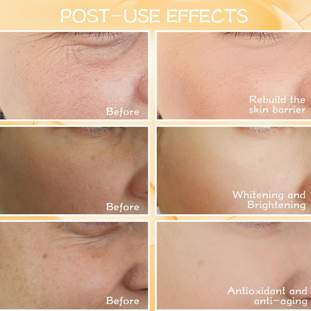Vitamin C & Retinol Serum Set for Face – Day & Night Serum to Visibly Reduce the Look of Fine Lines with Hyaluronic