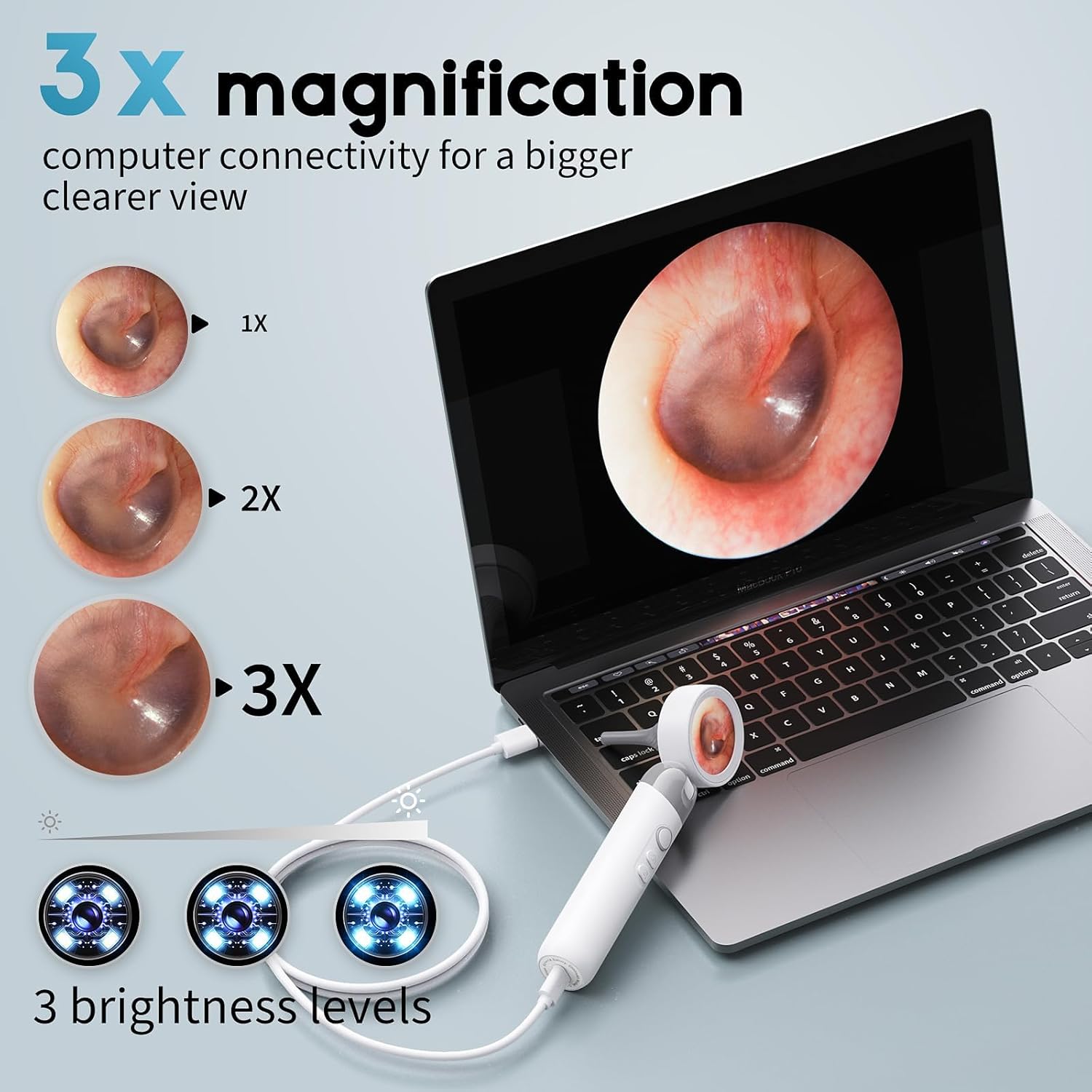 Digital Otoscope Ear Camera for Family, 1.38-Inch Screen, No App Needed