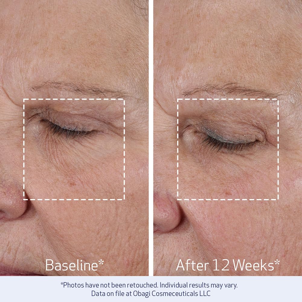 Obagi ELASTIderm Lift Up & Sculpt Facial Moisturizer – Clinically Proven Anti-Aging Face Cream that Visibly Firms &