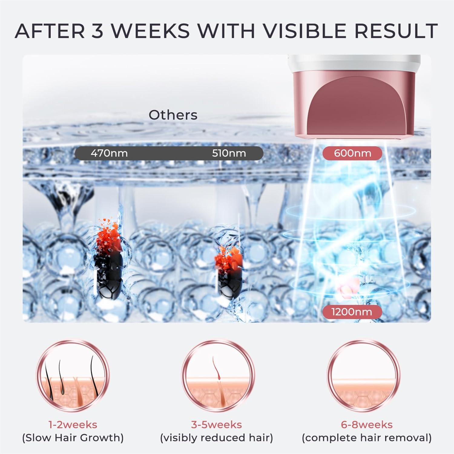 IPL Laser Hair Removal for Women and Men, Hair Removal with Ice-Cooling for Nearly Painless and Long-Lasting Result