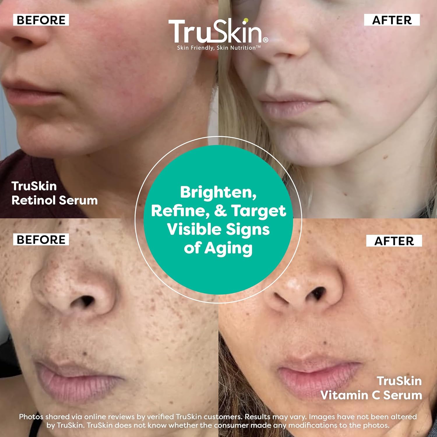 Face Serum Duo - Vitamin C Serum & Retinol Serum for Face - AM & PM Anti Aging Skincare Routine - Brightening &