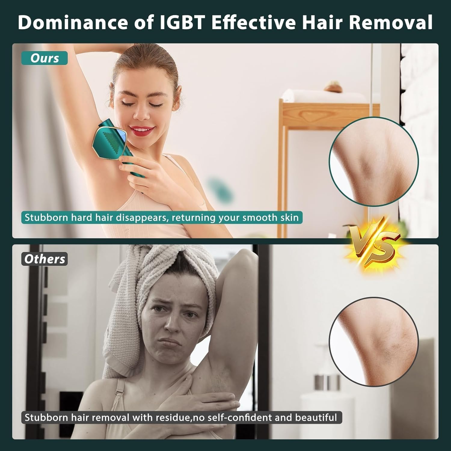 IPL Laser Hair Removal for Women and Men, Long-Lasting Results,999,999 Flashes Painless Hair Removal, 3-In-1