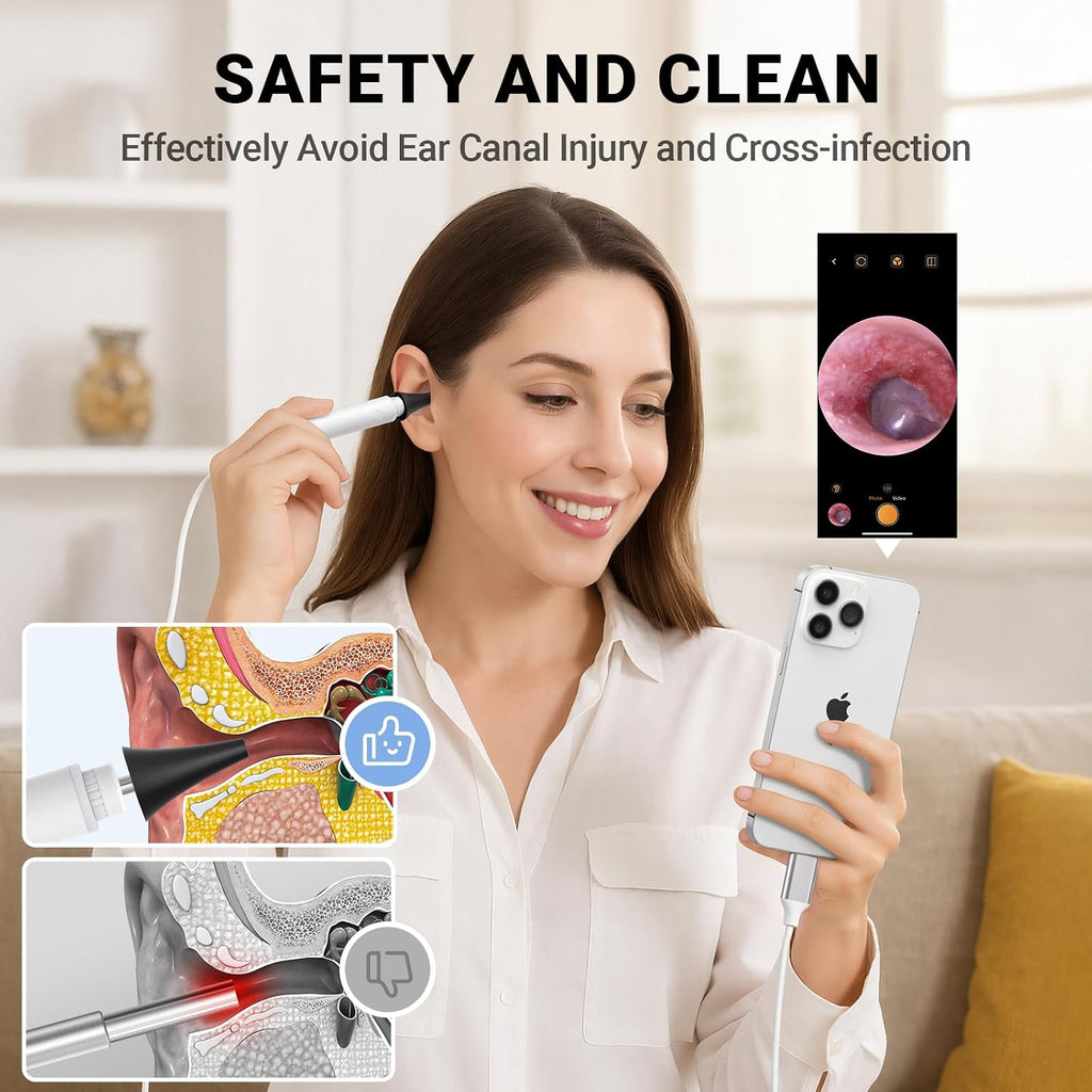 Otoscope Camera with Light 720P HD, USB-C Ear Camera, Plug & Play Ear Scope