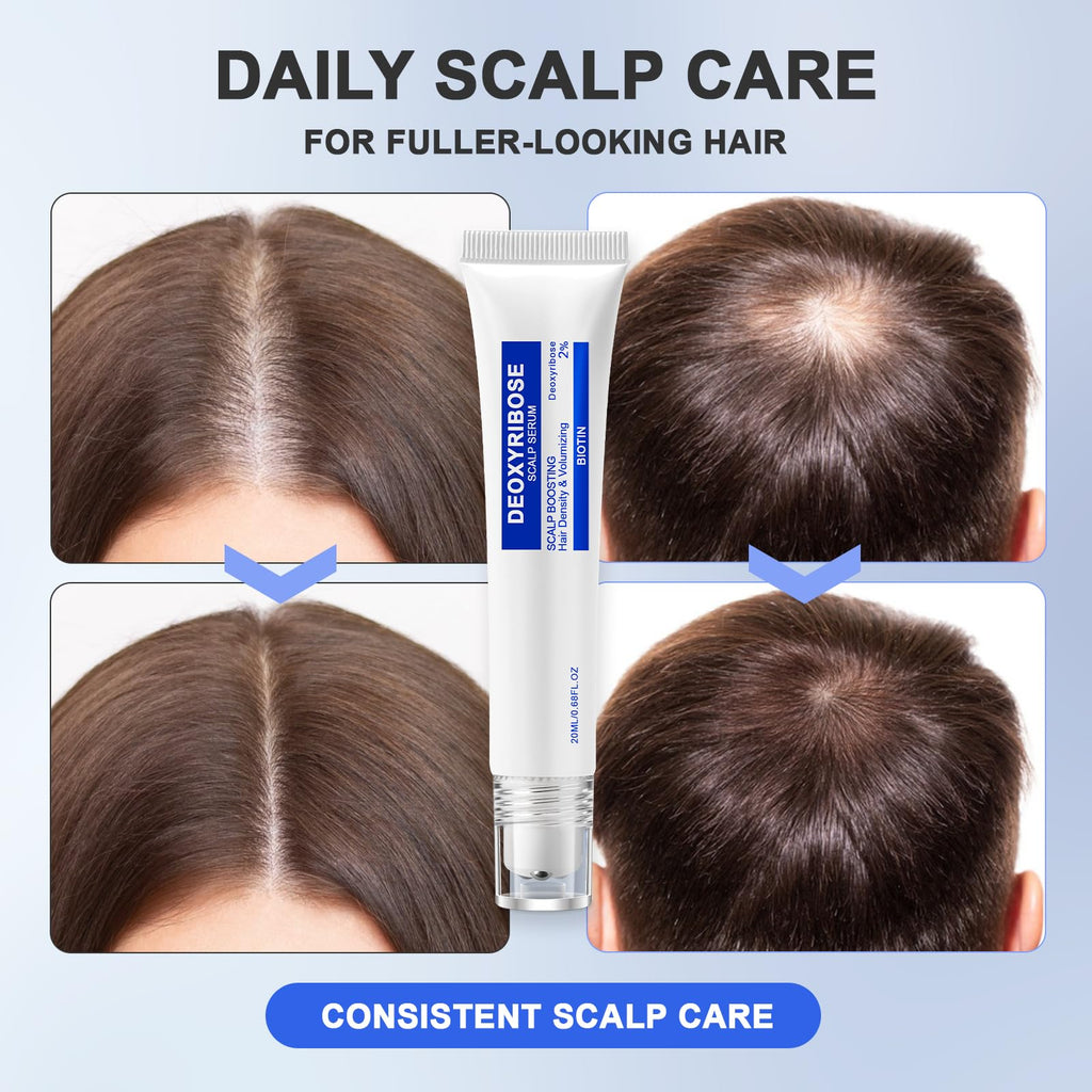 Scalp Serum with Deoxyribose with Roller Applicator for Fuller Looking Hair