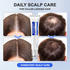 Scalp Serum with Deoxyribose with Roller Applicator for Fuller Looking Hair