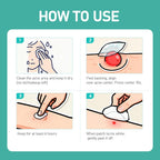 Pimple Patches Microdart, Zit Patches with Microdart Technology