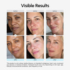 Collagen and Retinol Deep Face Moisturizer - Face Cream for Women