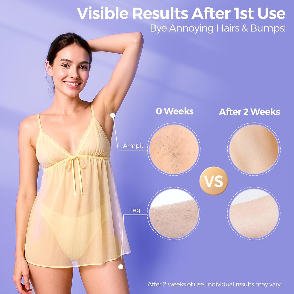 2026 Upgraded Laser Hair Removal with 5℃ Ice Cooling, Painless IPL Laser Hair Removal Device for Women & Men, 999,999