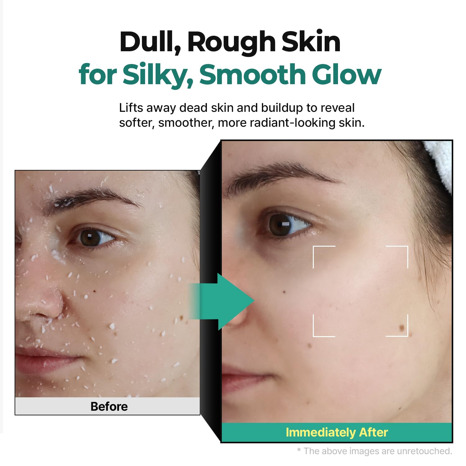 LHA Green Tea Exfoliating Aqua Peel Gel, Deep Pore Face Exfoliant, Gentle Facial Exfoliator, Dead Skin Remover