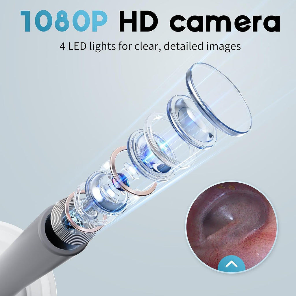 Otoscope Ear Camera with 1.21” Screen, 1080P Ear Scope with 4 LED Lights, Otoscope Camera for Adults, Support Photo &