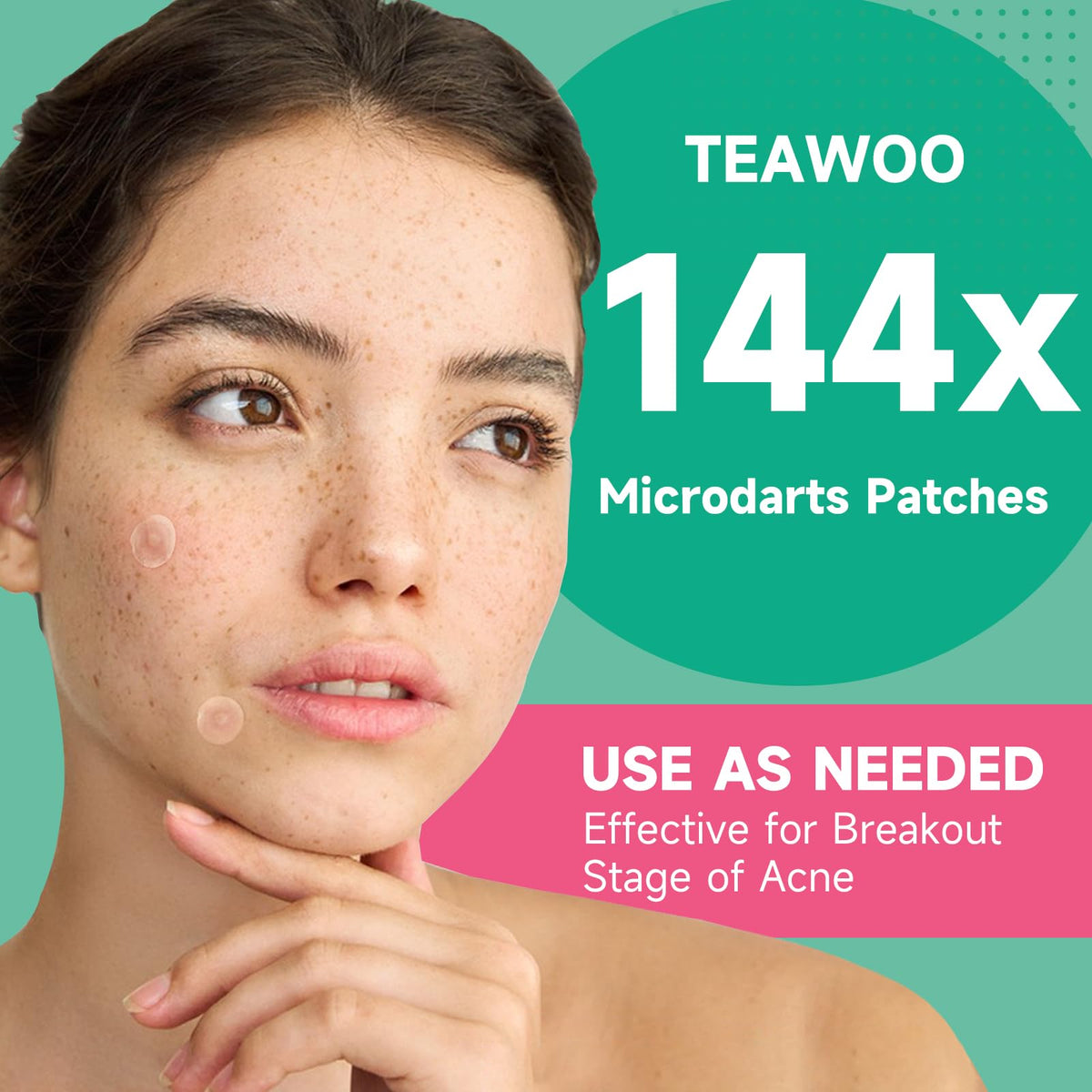 144-Count Microdart Acne Patches, Hydrocolloid Pimple Patches(Patented)