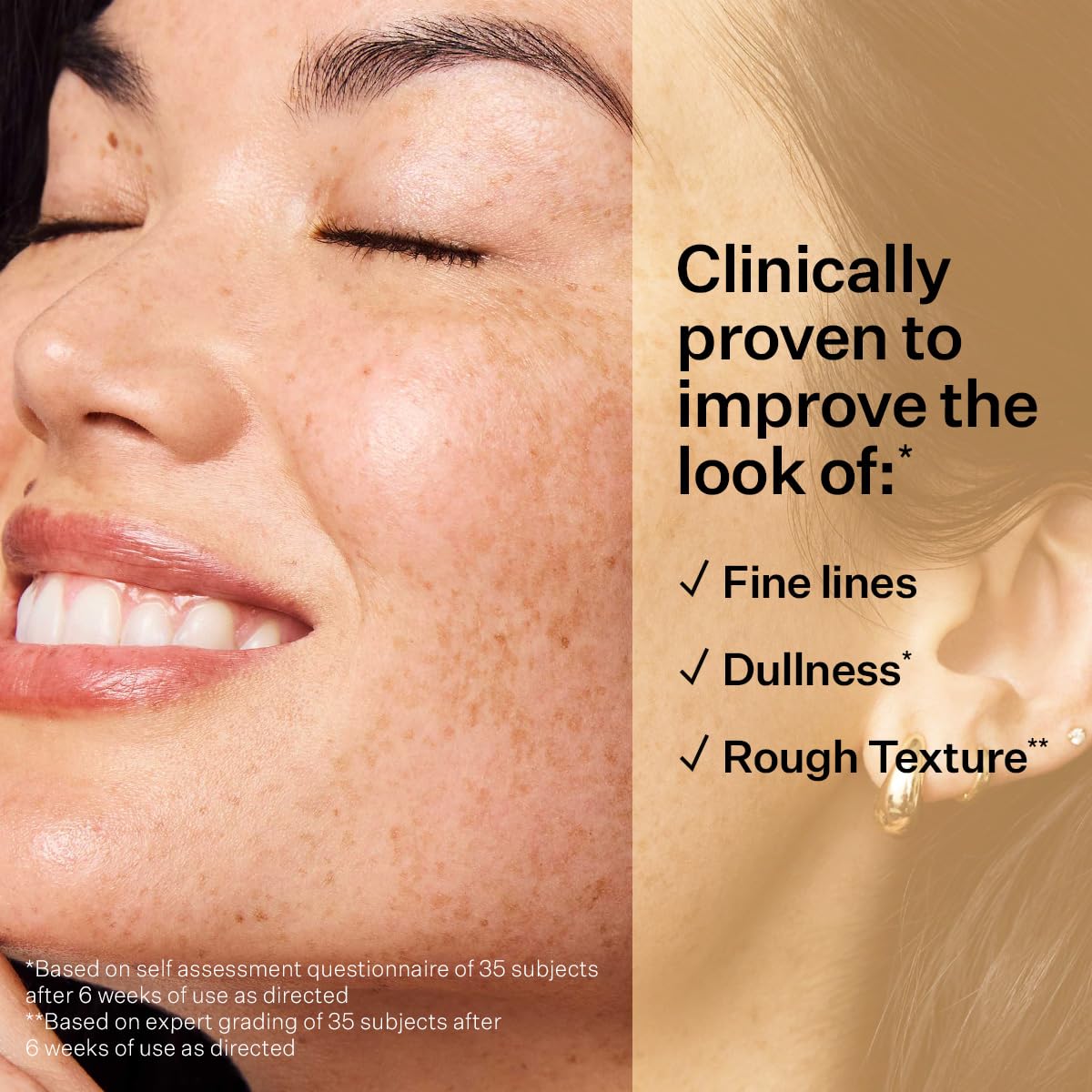 StriVectin Super-C Retinol Brighten & Correct Vitamin C Serum, Antioxidant Face Serum for Uneven Tone, Fine Lines