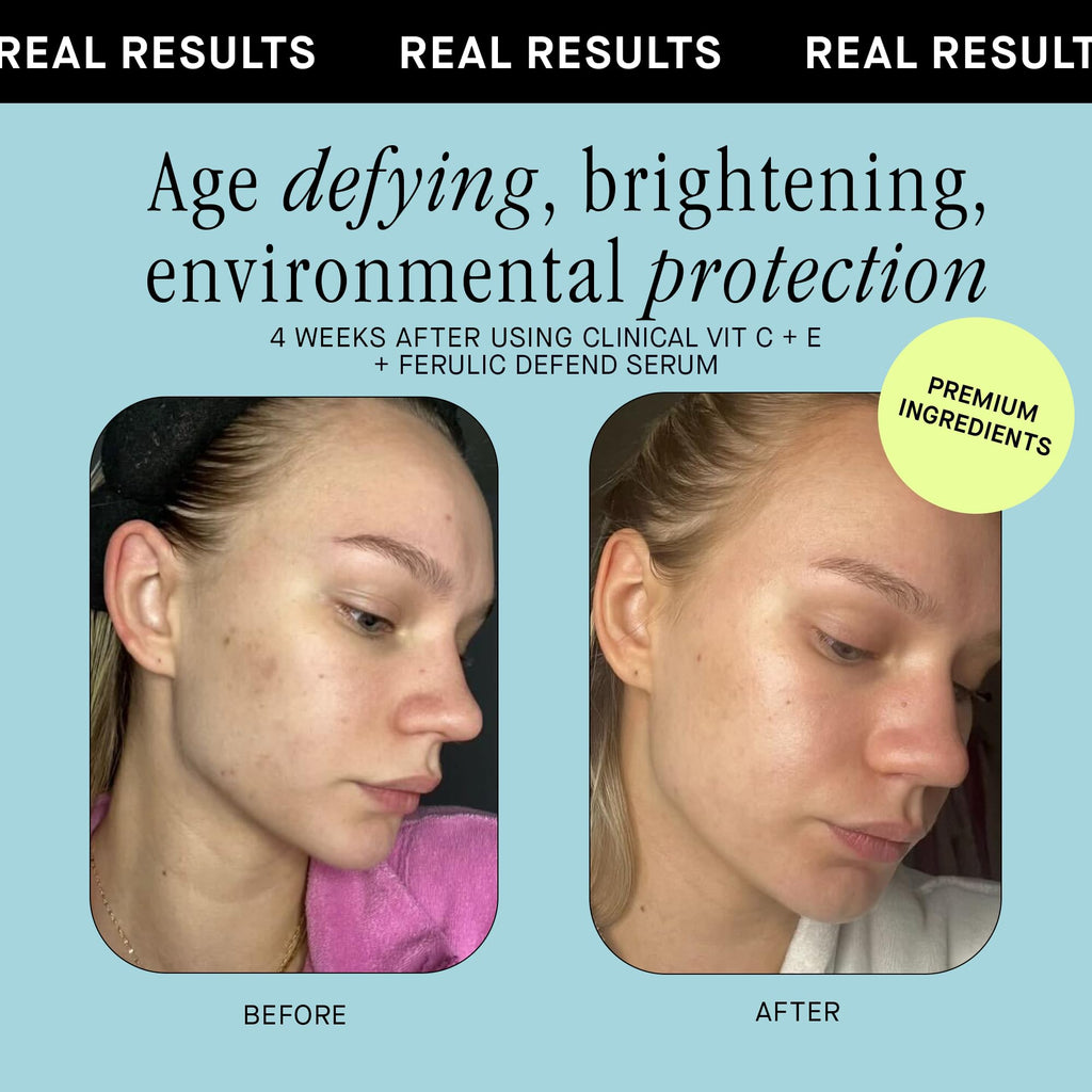 Vitamin C Face Serum 15% L-Ascorbic Acid + Ferulic Acid