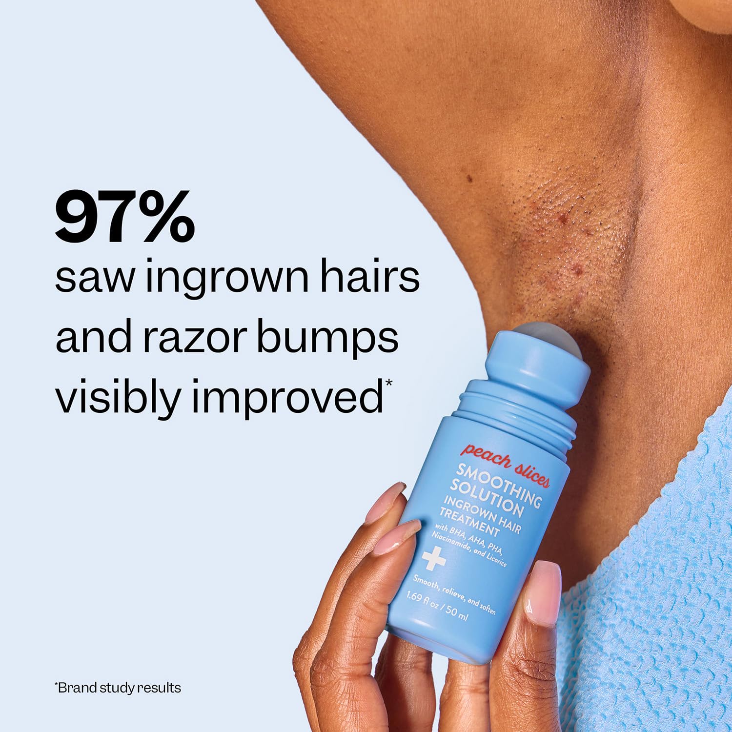 Smoothing Solution Ingrown Hair Treatment (1.69 oz) - Smooth, Relieve, Soften Skin - 360 Roller - BHA, AHA, PHA