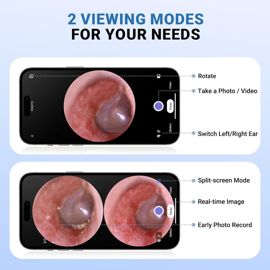 WiFi Digital Otoscope with IPS Screen, 720P HD Otoscope Camera for Home Use