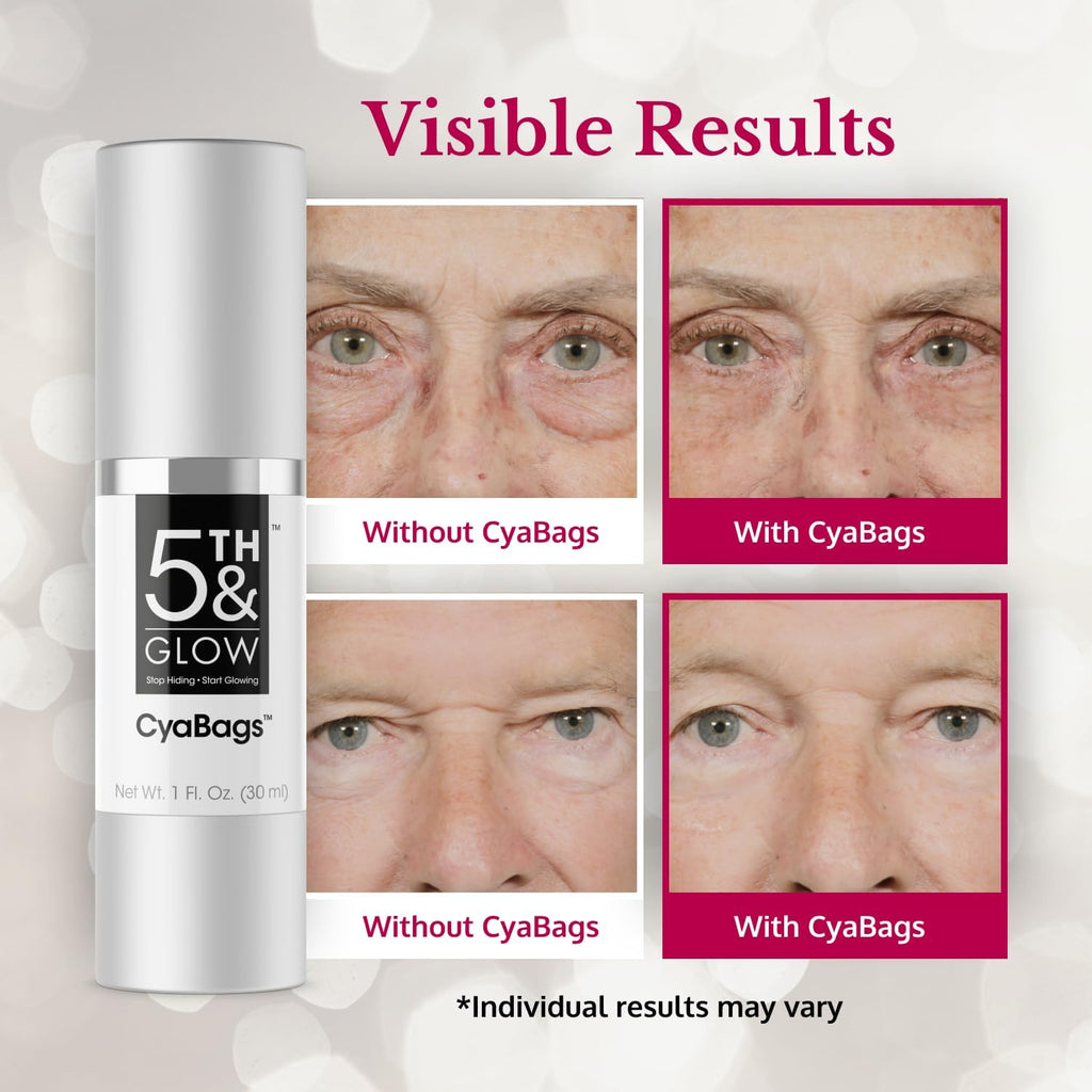 Cyabags - Instant Puffy Eyes Reduction & Under Eye Bag Remover Serum For Women - Hyaluronic Acid & Vitamin C Cream