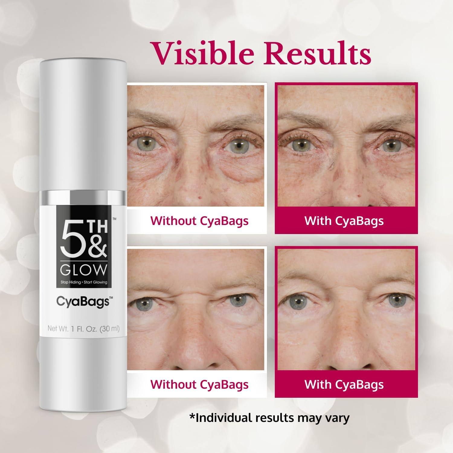 Cyabags - Instant Puffy Eyes Reduction & Under Eye Bag Remover Serum For Women - Hyaluronic Acid & Vitamin C Cream