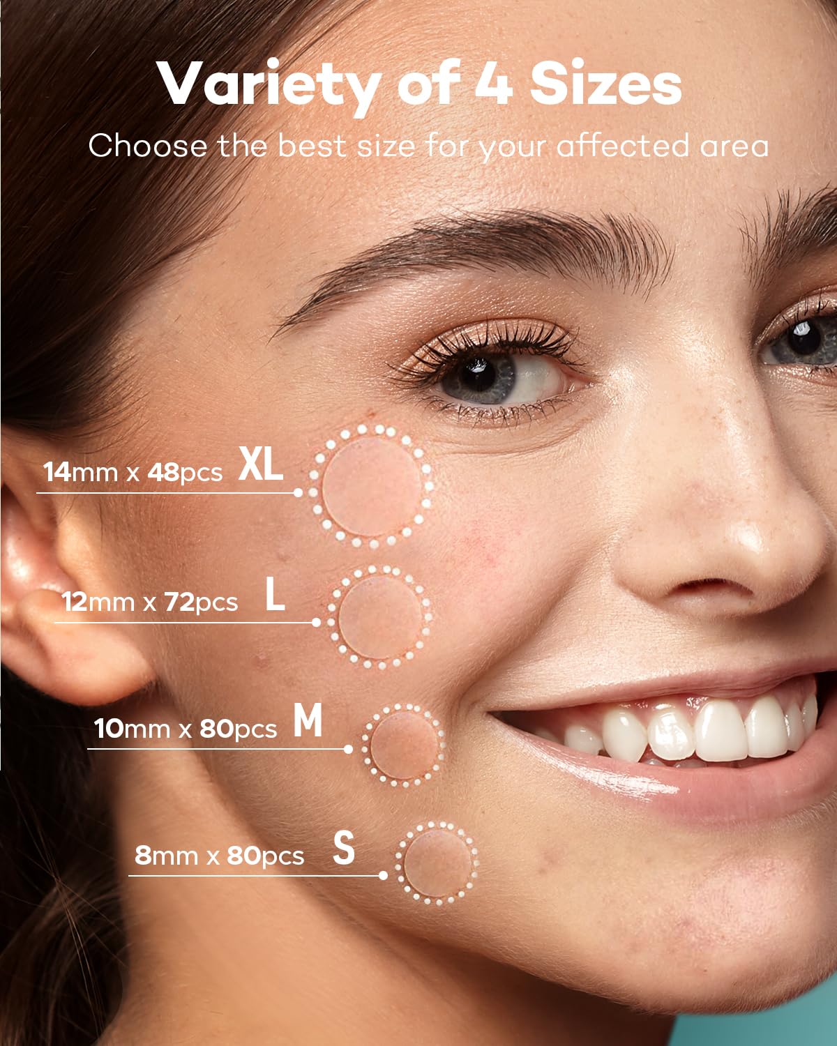 Pimple Patch Acne Patch, 4 Sizes 280 Patches Acne Absorbing Cover Patch, Hydrocolloid Invisible Acne Patches for Face
