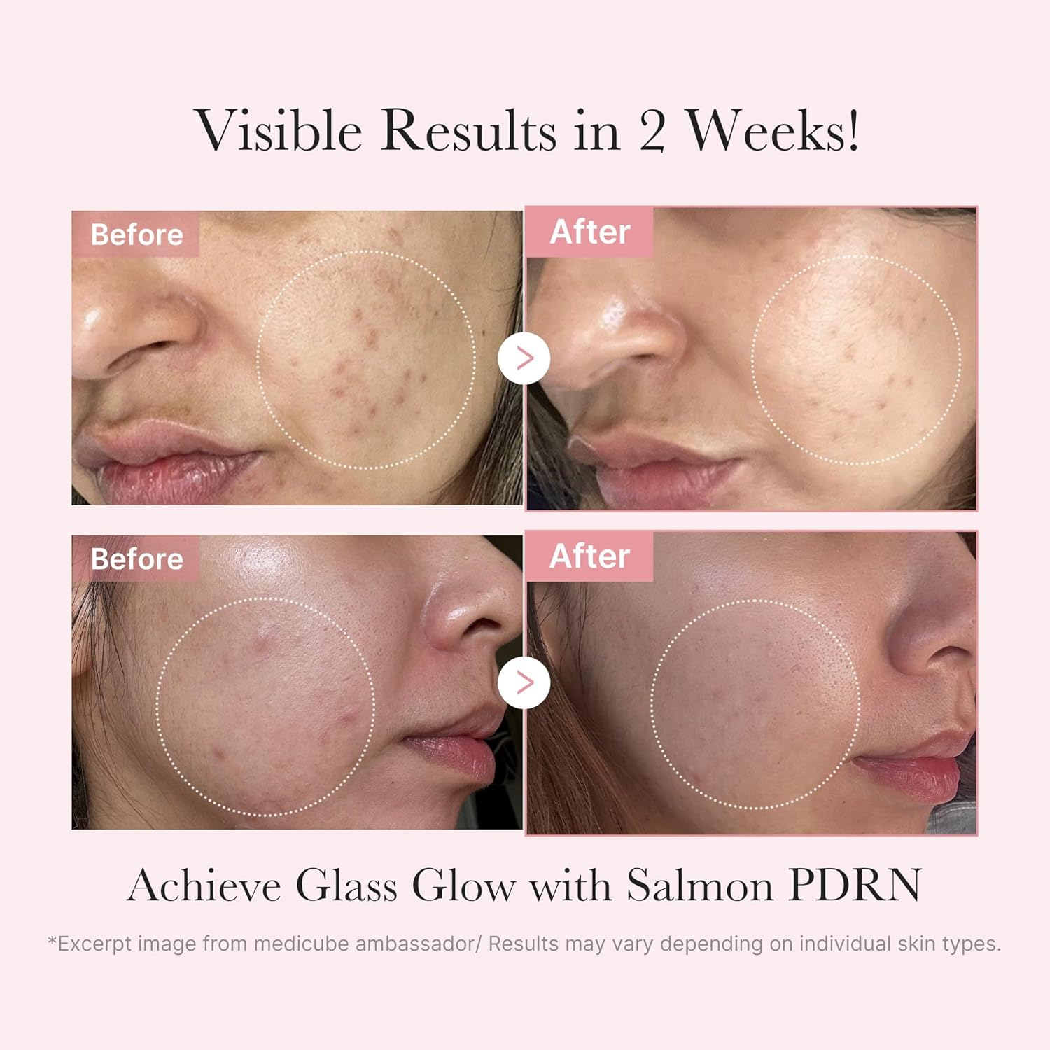 Salmon DNA PDRN Trial Kit | Glass Glow Mini Skincare Set with Toner, Serum & Sheet Mask for Hydrating, Firming