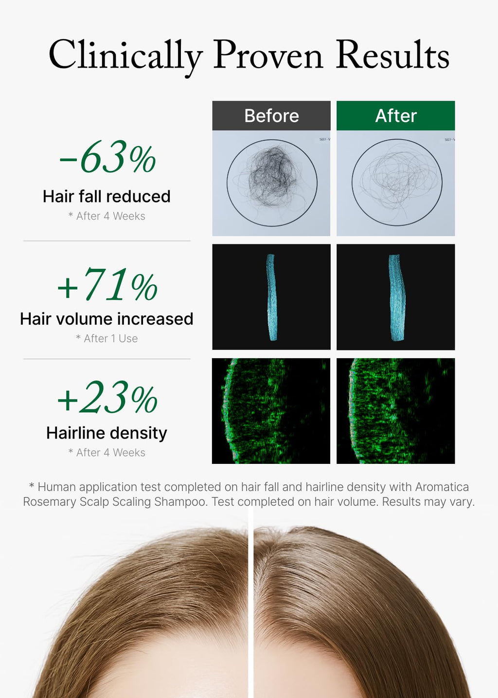 Rosemary Scalp Scaling Shampoo for Hair Growth