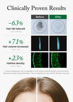 Rosemary Scalp Scaling Shampoo for Hair Growth