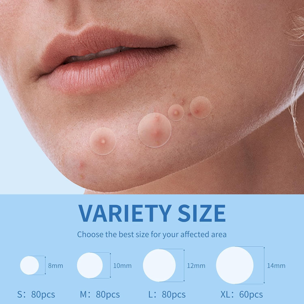 Pimple Patches for Face, 4 Size 300 Counts Acne Patches, Hydrocolloid Patches for Covering Zits and Blemishes, Spot