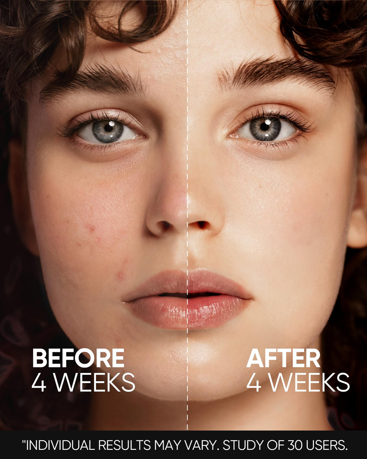 Beginner Retinol Serum with 0.1% Retinol & Zinc PCA, 20ml