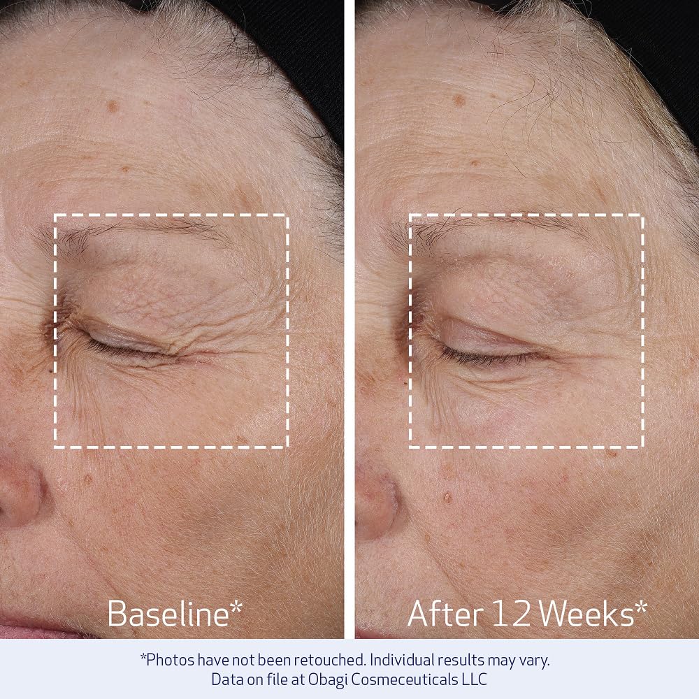Obagi ELASTIderm Lift Up & Sculpt Facial Moisturizer – Clinically Proven Anti-Aging Face Cream that Visibly Firms &