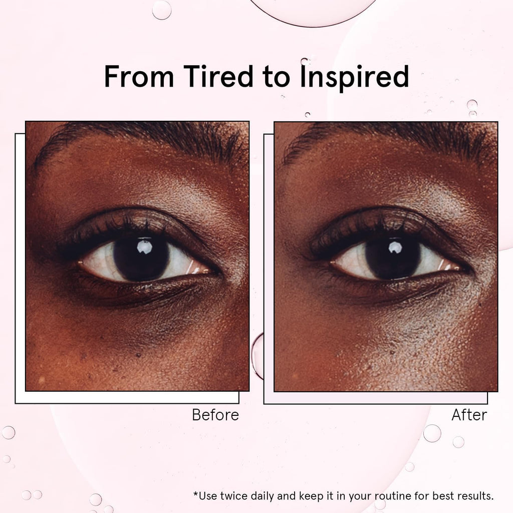 Under Eye Brightener with Cooling Metal Rollerball | Centella Asiatica & Caffeine Eye Serum for Puffy Eyes - Travel