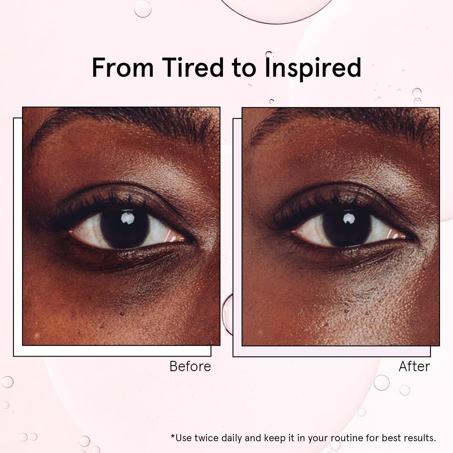Under Eye Brightener with Cooling Metal Rollerball | Centella Asiatica & Caffeine Eye Serum for Puffy Eyes - Travel