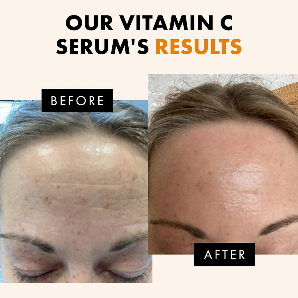 Vitamin C Serum - Skin Care for Dark Spots, Vitamin C Serum for Face with Hyaluronic Acid, Ferulic Acid, & Vit E